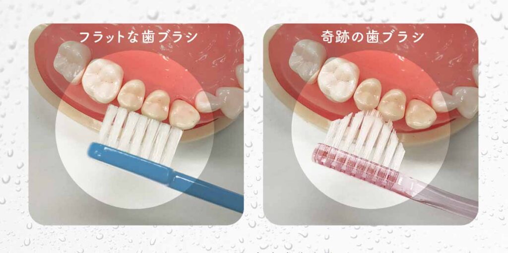 奇跡の歯ブラシとフラットな歯ブラシの比較